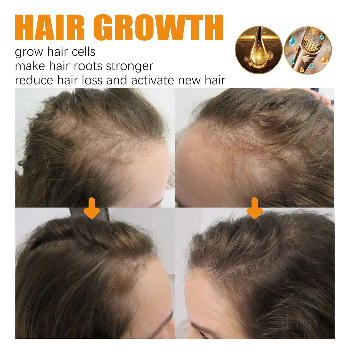 Biotin Hair Care Ball Gentle Ingredients Nourish And Moisturize Hair, Smooth And Glossy Hair Care Ball