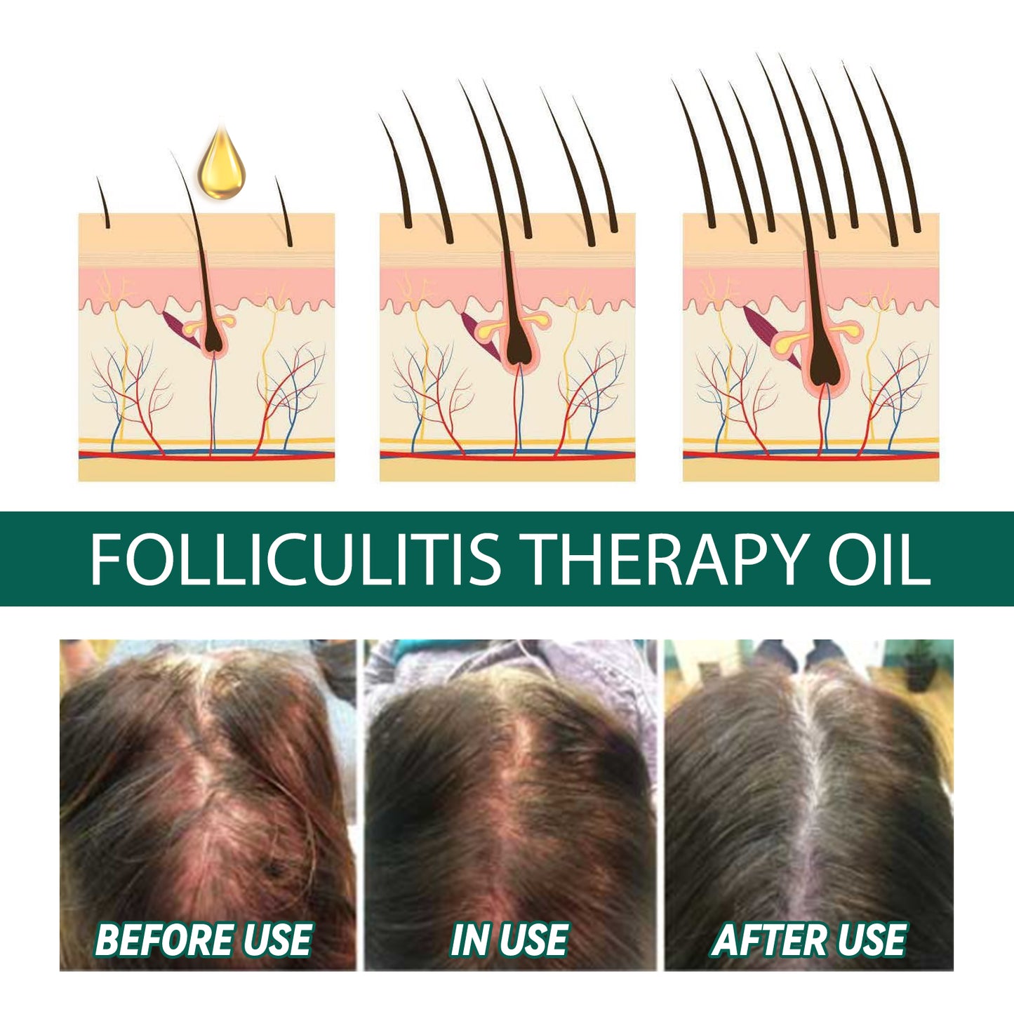 Essential Oil For Scalp, And Hair Scalp Deep Cleaning And Repair Hair Root Anti-Itching And Anti-Loss Hair Solid Care Essential Oil