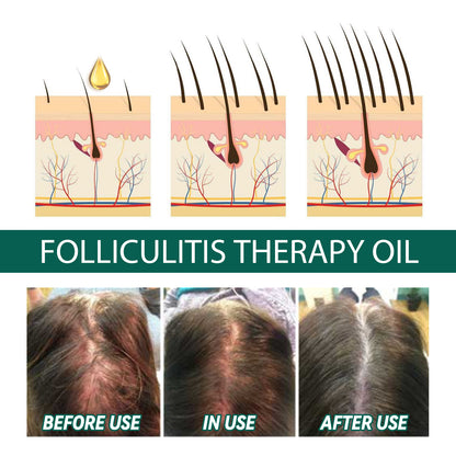 Essential Oil For Scalp, And Hair Scalp Deep Cleaning And Repair Hair Root Anti-Itching And Anti-Loss Hair Solid Care Essential Oil