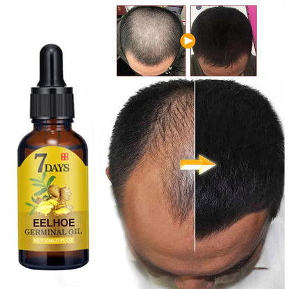 Ginger Hair Care Solution For Hair Nourishing And Moisturizing Hair Care For Hair Stabilizing And Preventing Hair Loss