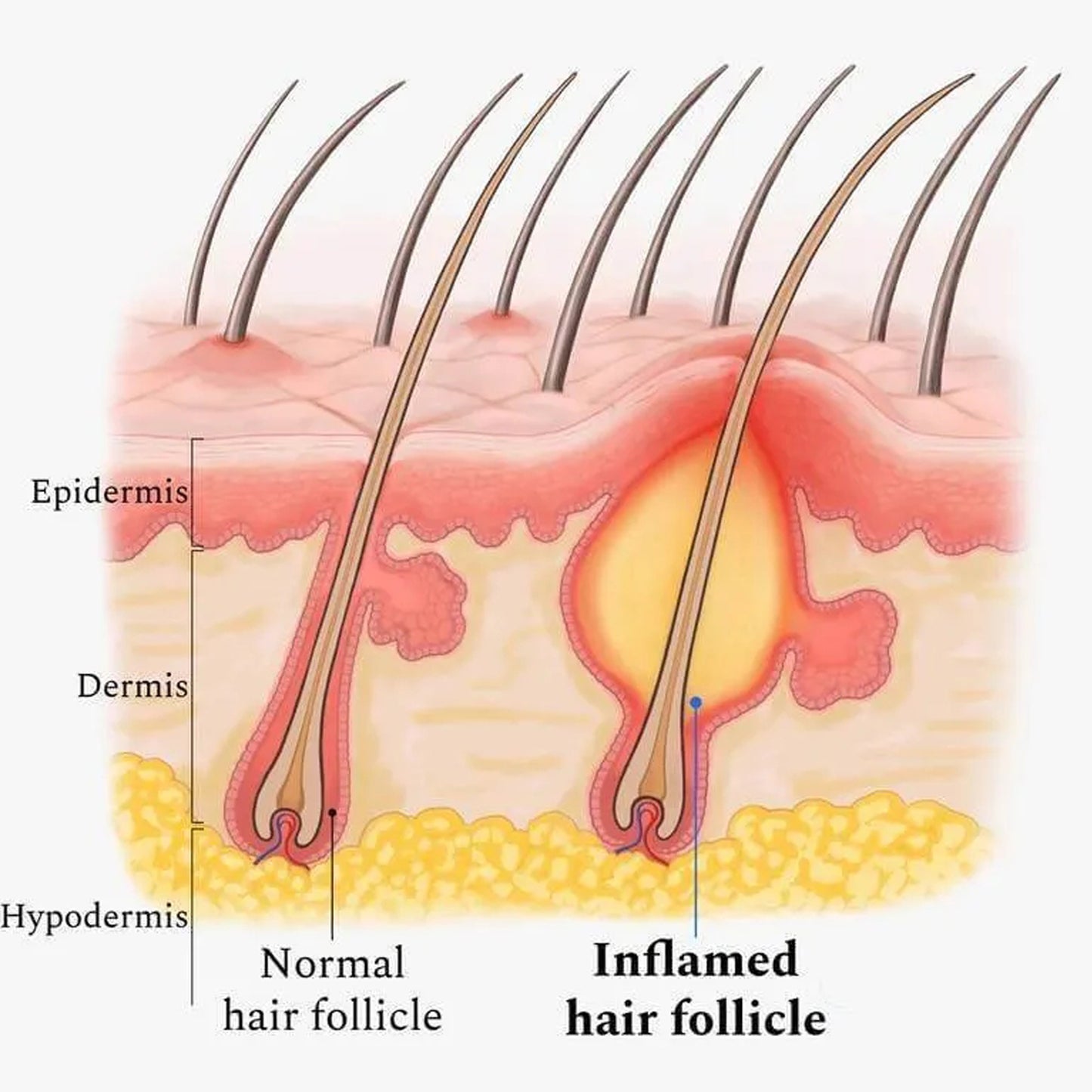 Essential Oil For Scalp, And Hair Scalp Deep Cleaning And Repair Hair Root Anti-Itching And Anti-Loss Hair Solid Care Essential Oil