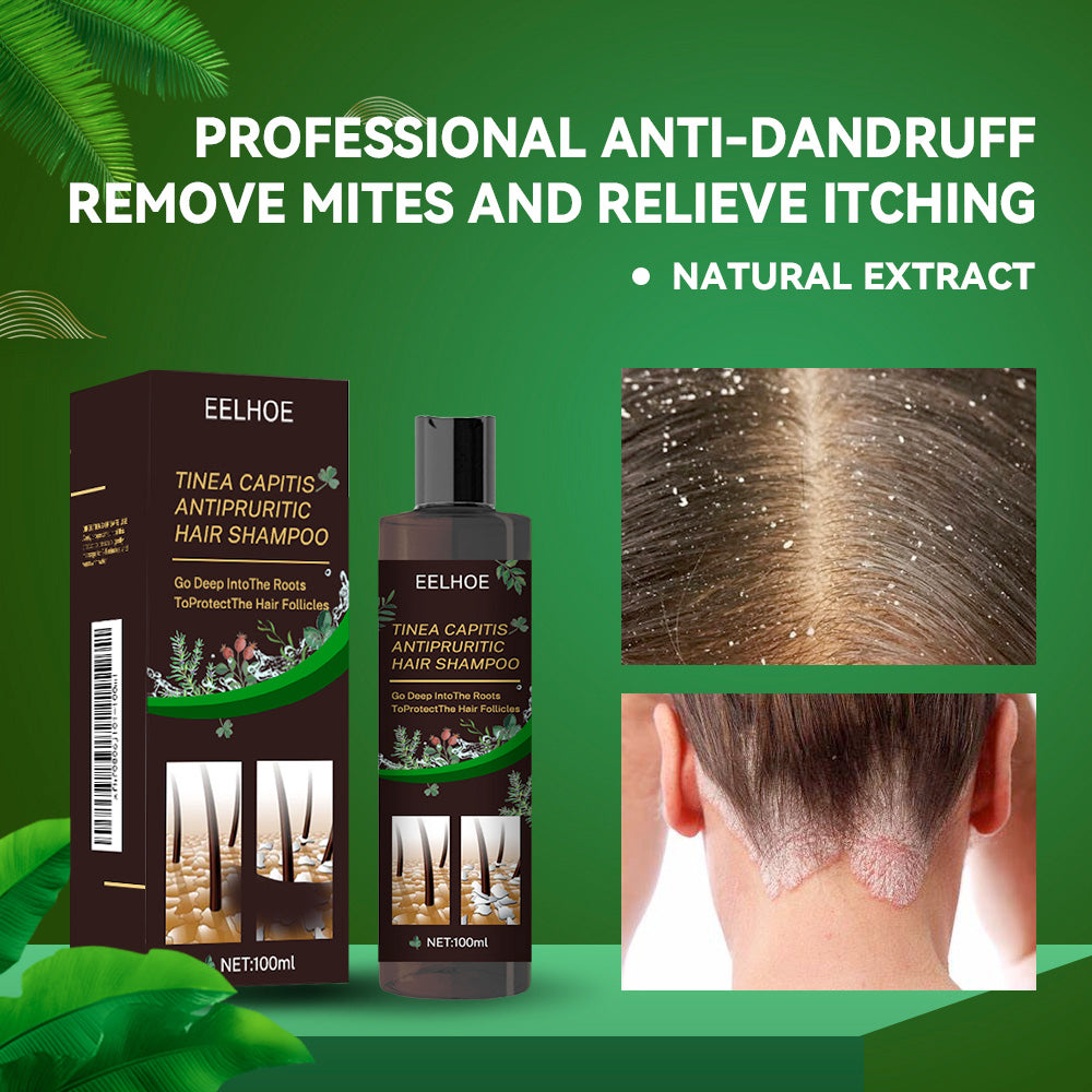 EELHOE Tinea Capitis Anti-Itch Shampoo Anti-Drop Refreshing Oil Control Hair Care Anti-Dandruff Anti-Itch Shampoo