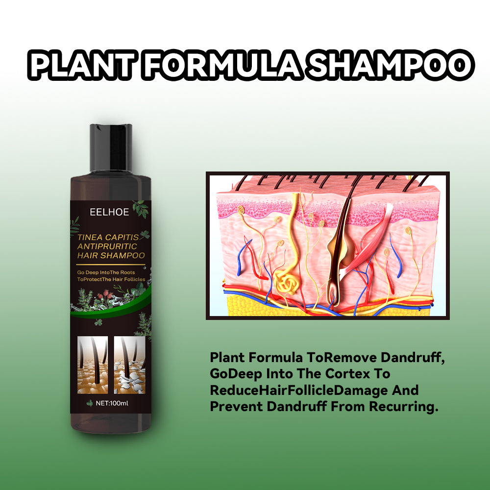 EELHOE Tinea Capitis Anti-Itch Shampoo Anti-Drop Refreshing Oil Control Hair Care Anti-Dandruff Anti-Itch Shampoo