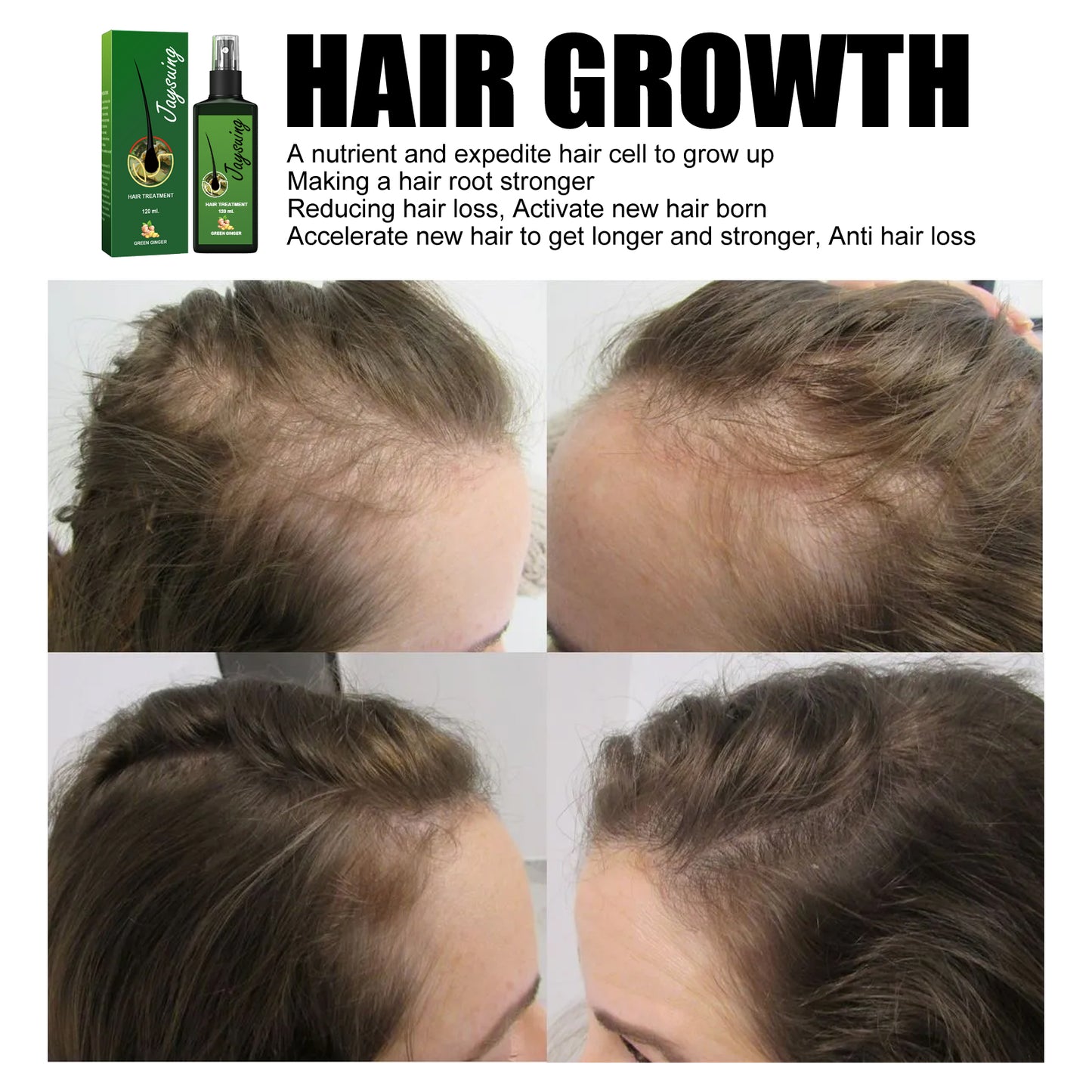 Jaysuing Hair Care Solution Gently Nourishes And Massages Scalp, Moisturizes And Softens Hair Care Spray