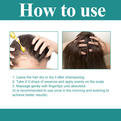 EELHOE Hair Care Essence, Nourishing And Moisturizing Hair, Soothing Hair And Scalp Massage Essence