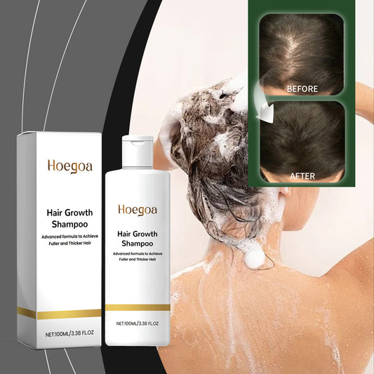 Hoegoa Rice Shampoo Scalp Cleansing Nourish Hair Repair Hair Follicles Smooth Hair Shampoo